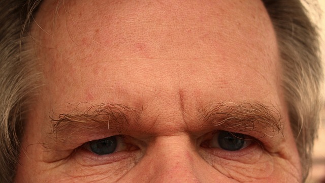 forehead
